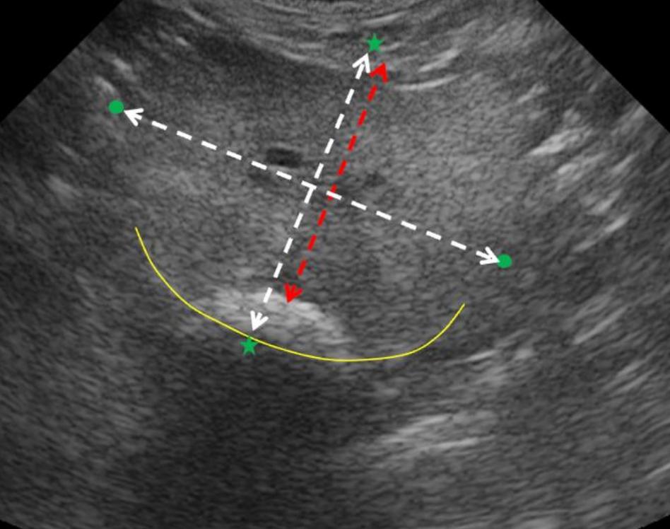 Prostate Screenshot 1