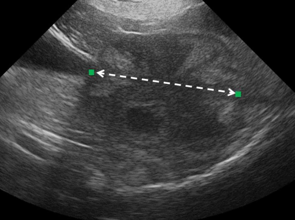 Prostate Screenshot 2